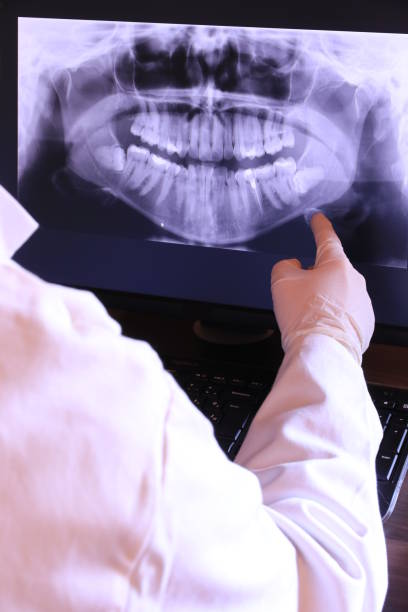 Best Emergency Broken Tooth Repair in Succasunna, NJ
