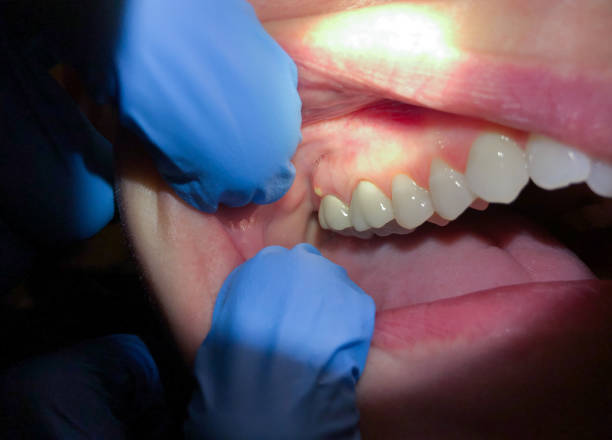 Best Emergency Dental Care for Trauma or Injury in Succasunna, NJ