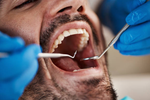 Best Emergency Dental Care for Trauma or Injury in Succasunna, NJ